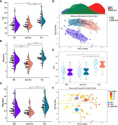 Alterations in Oral Microbiota of Differentiated Thyroid Carcinoma Patients With Xerostomia After Radioiodine Therapy